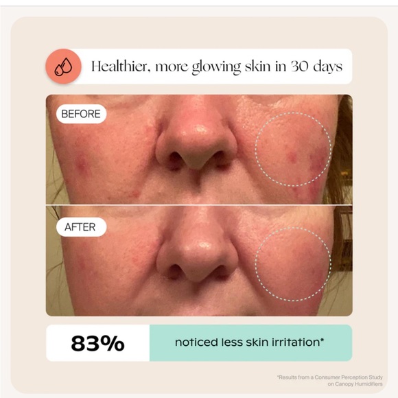 Canopy Bedside Humidifier 2.0 - Picture 13 of 14